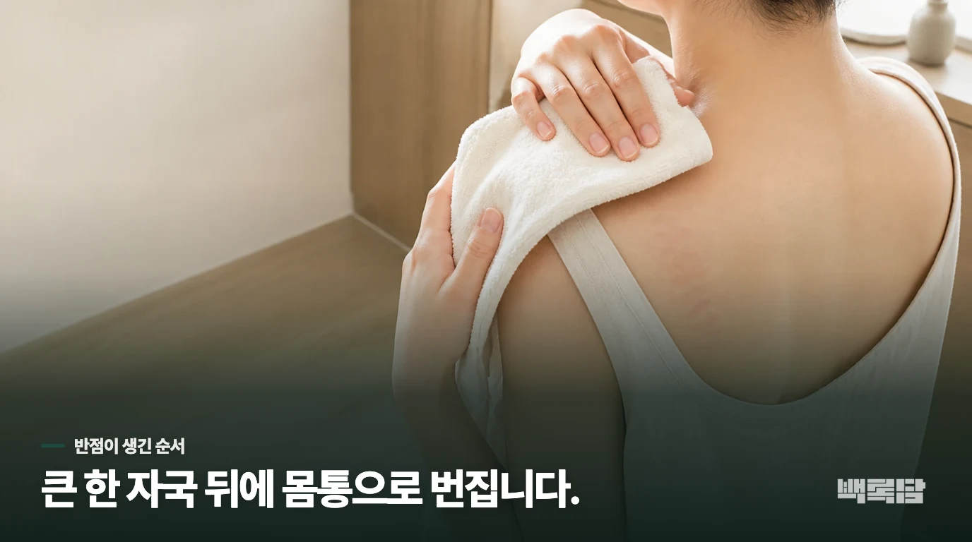 큰 반점 뒤에 몸통으로 번지는 순서