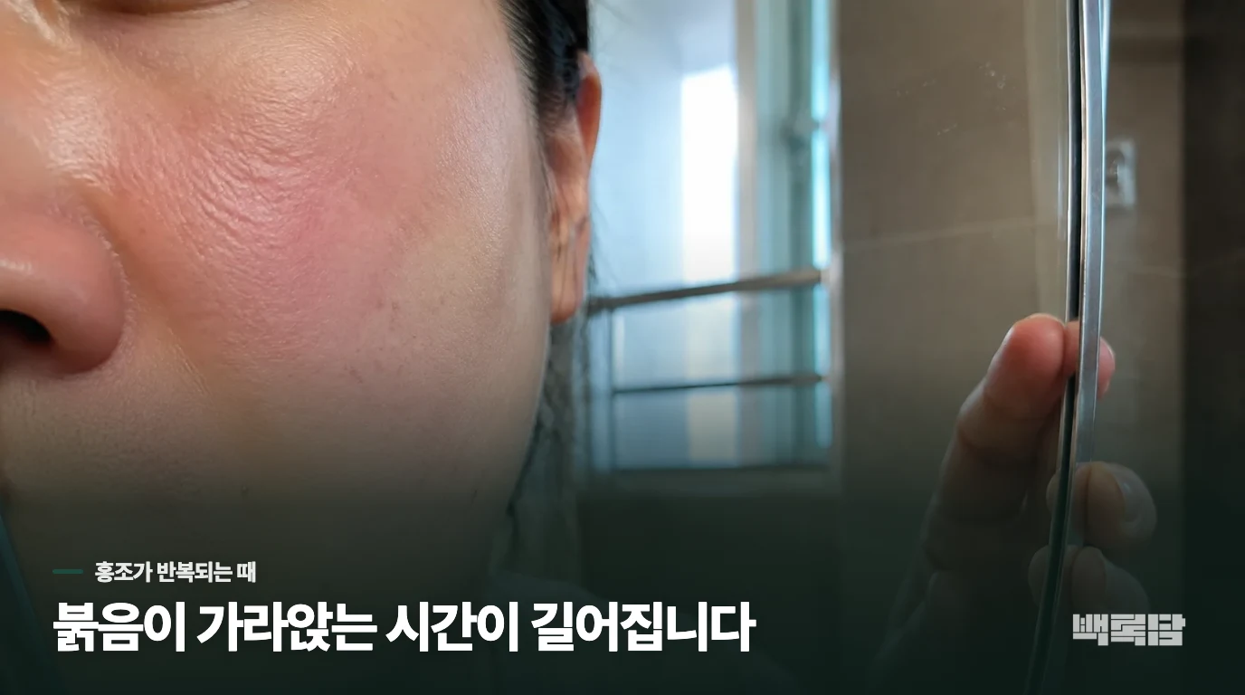주사비는 얼굴이 달아오르는 때부터 양상이 드러납니다