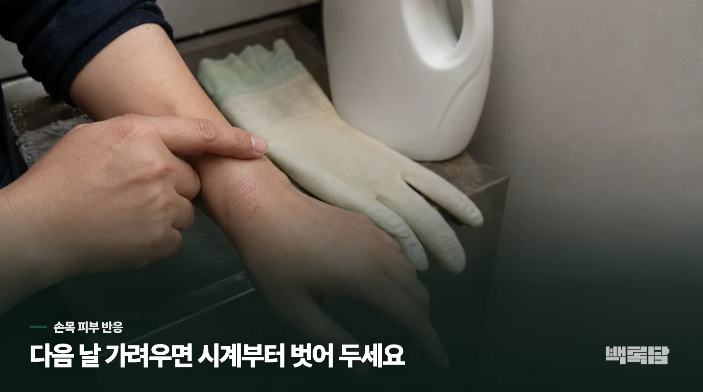 시계를 벗은 다음 날에도 손목이 가렵다면
