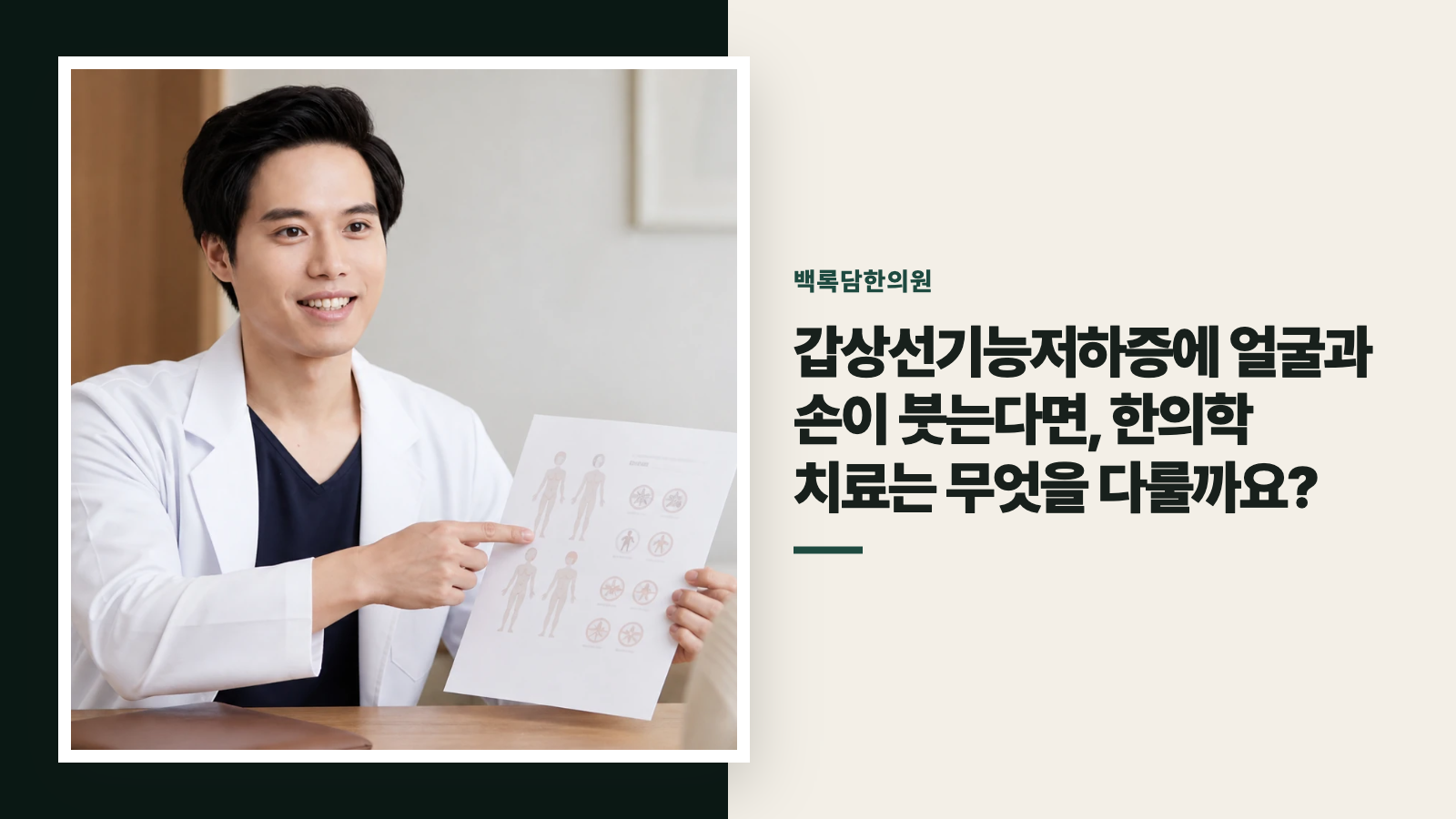 갑상선기능저하증에 얼굴과 손이 붓는다면, 한의학 치료는 무엇을 다룰까요?