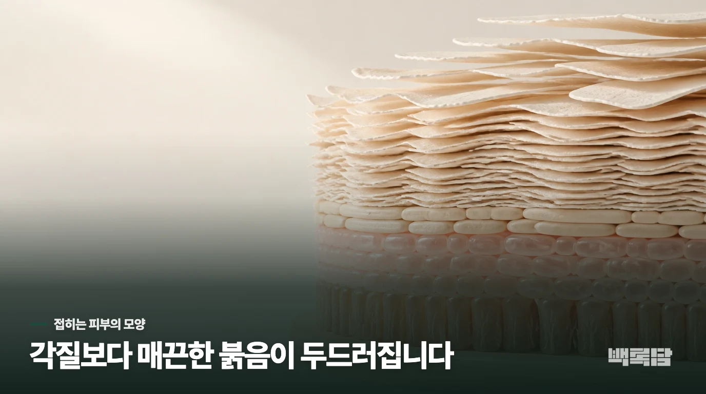 겨드랑이와 사타구니의 건선은 왜 각질이 적을까요?