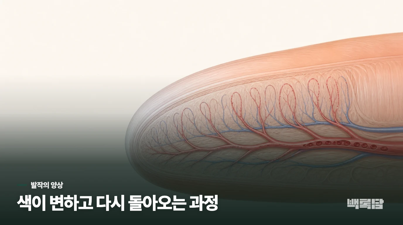 하얗게 변한 뒤 파래지고 붉어질 수 있습니다