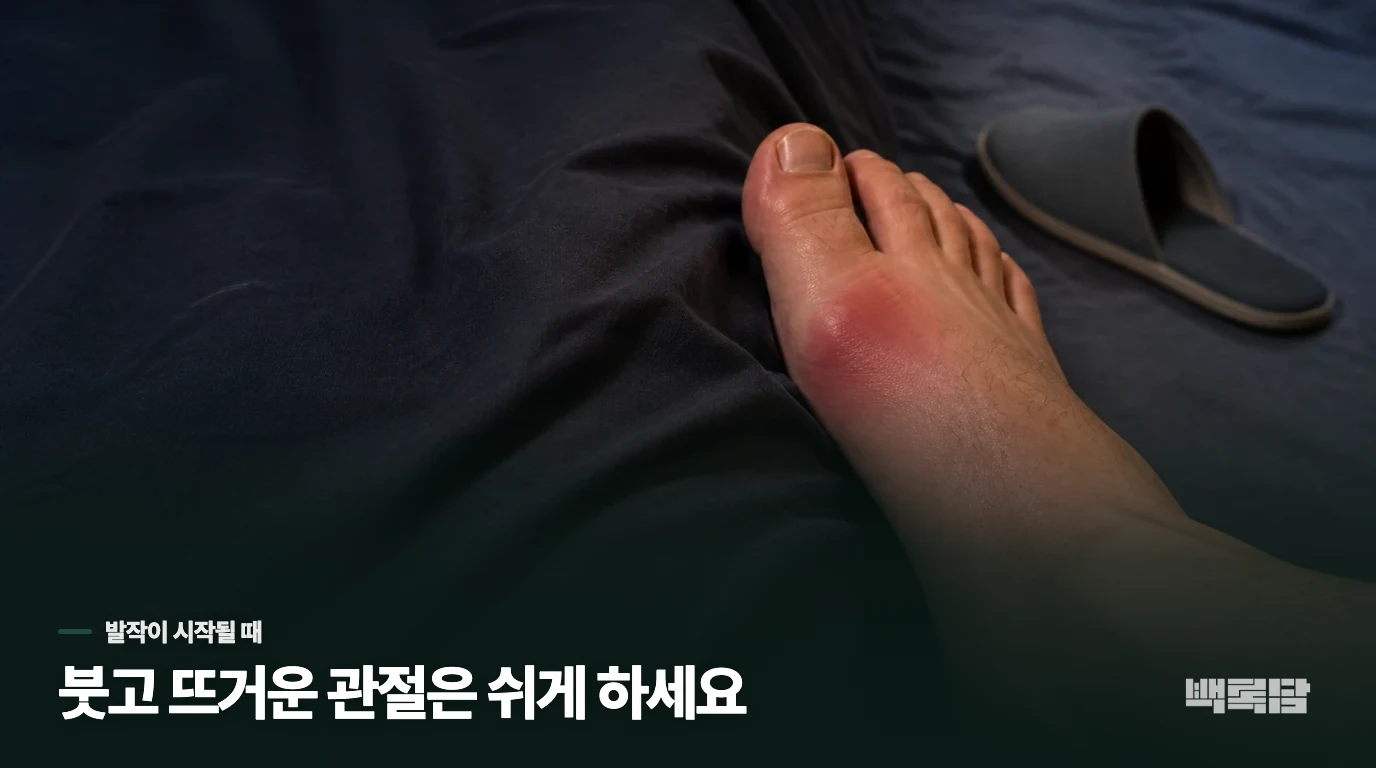 갑자기 붉고 뜨거운 관절, 발작 중 목표는 무엇일까요?