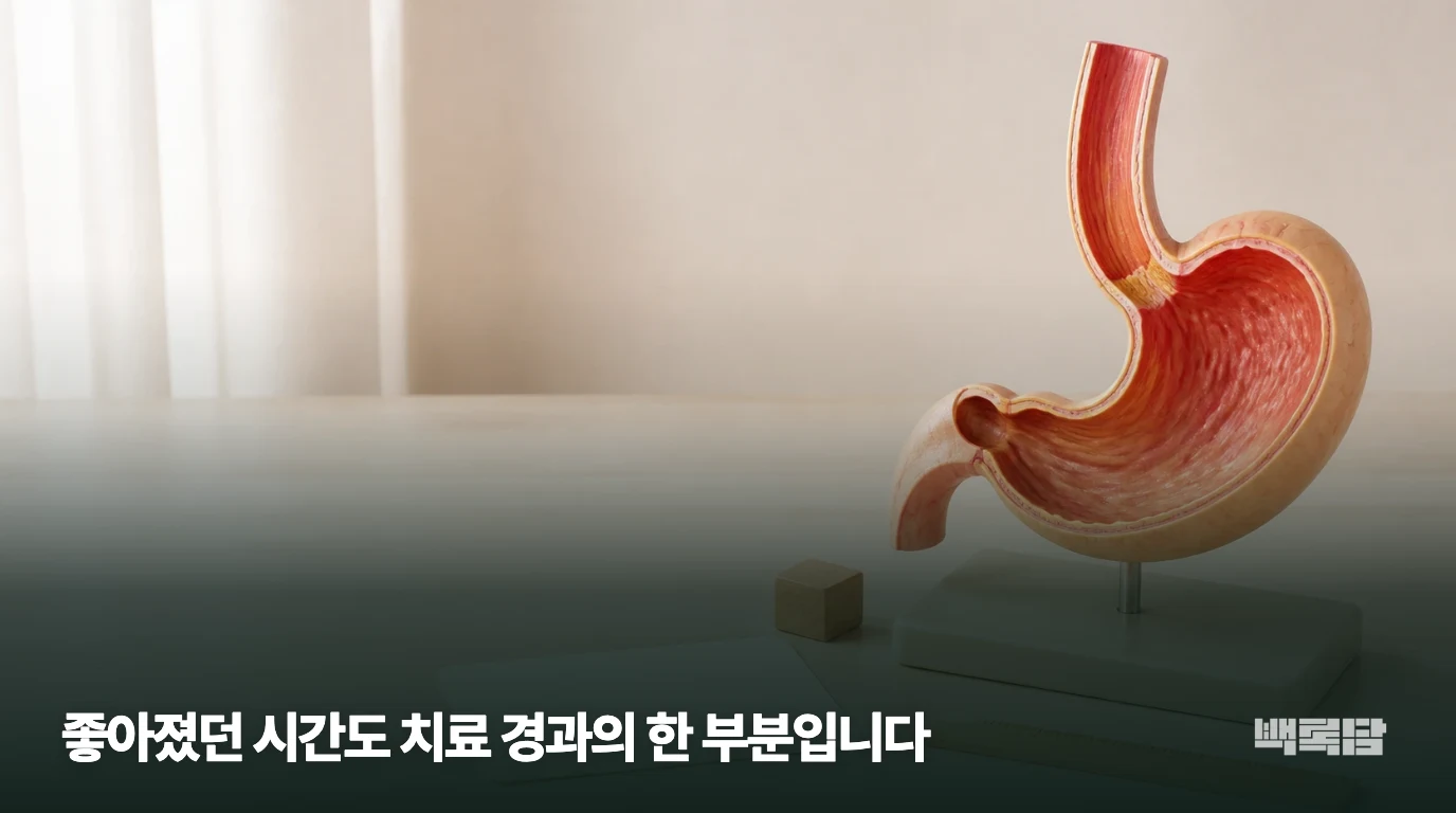 식도와 위의 위치를 보여주는 설명용 모형이며 실제 검사 영상은 아닙니다