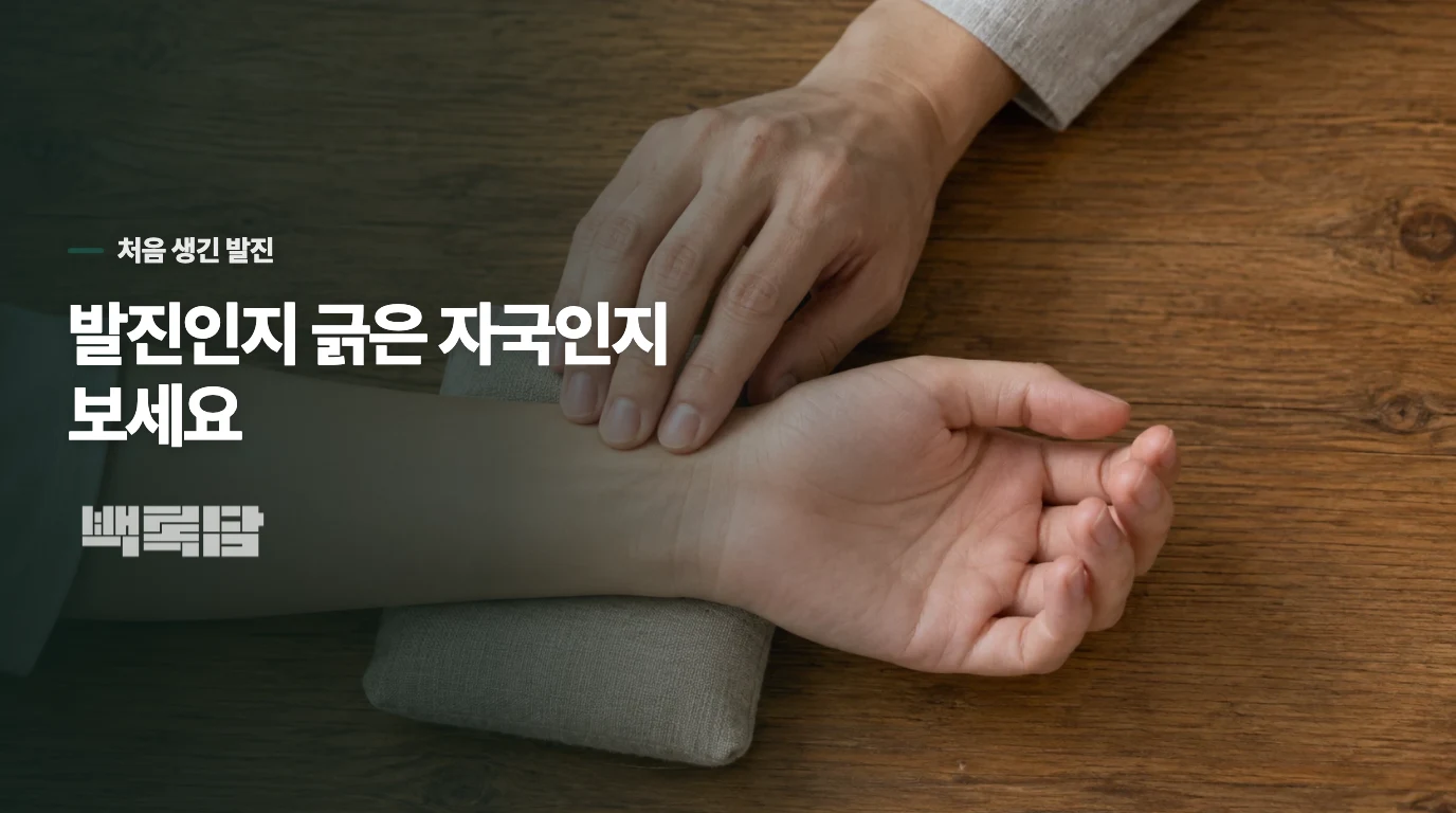 붉은 발진인지, 긁은 자국만 남았는지부터 살펴보세요