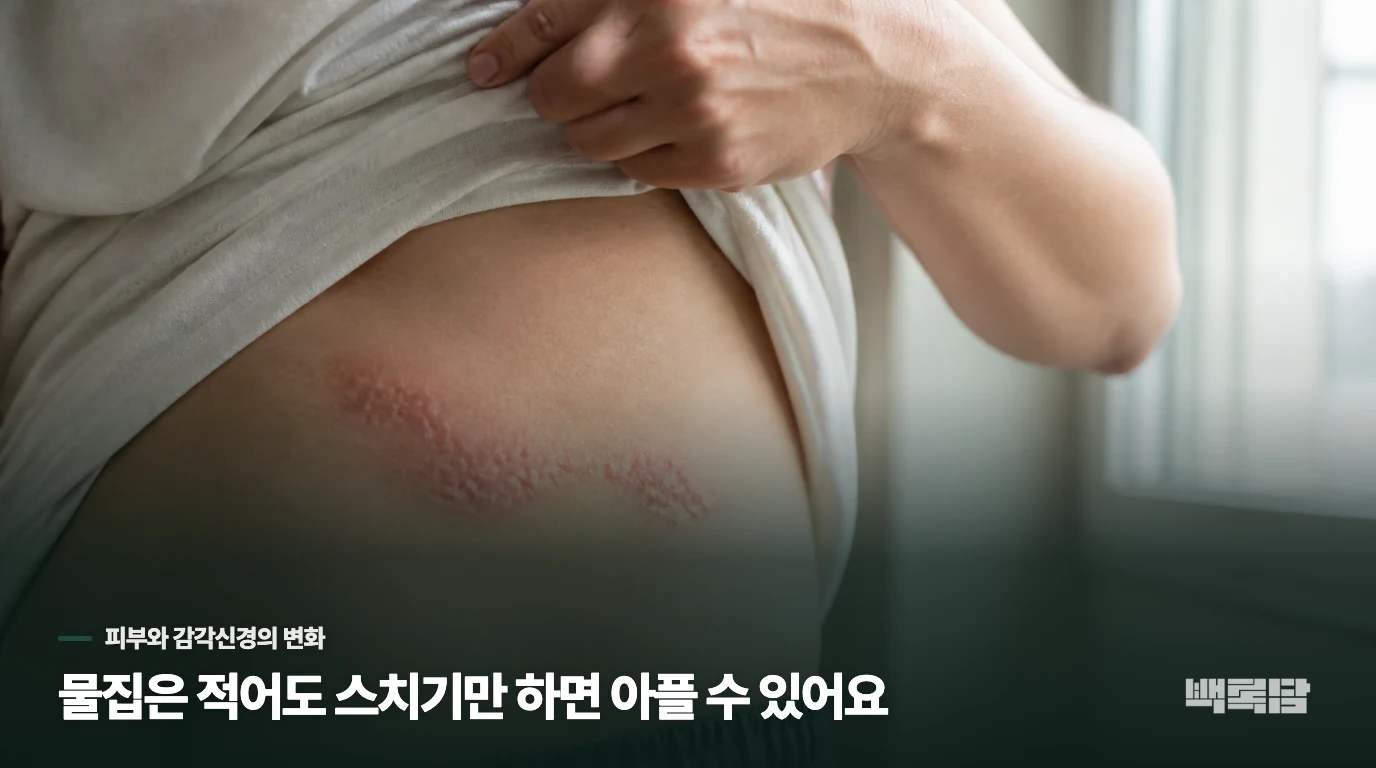 물집은 적어도 스치기만 하면 아플 수 있어요