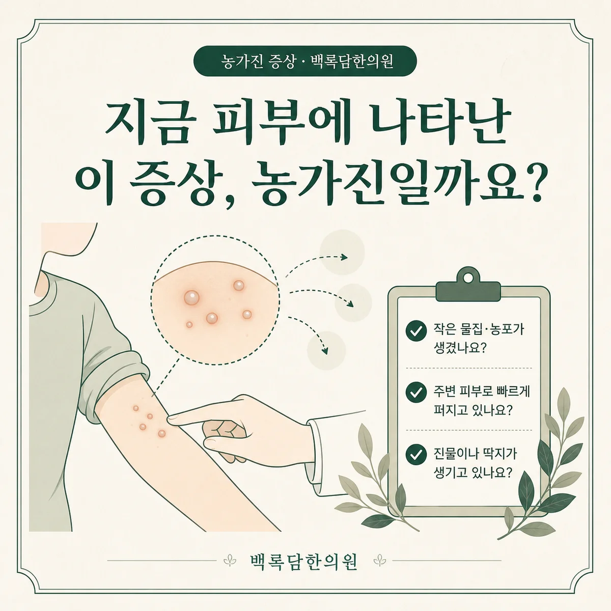 지금 피부에 나타난 이 증상, 농가진일까요? — 섹션 주제를 상징하는 에디토리얼 일러스트 카드