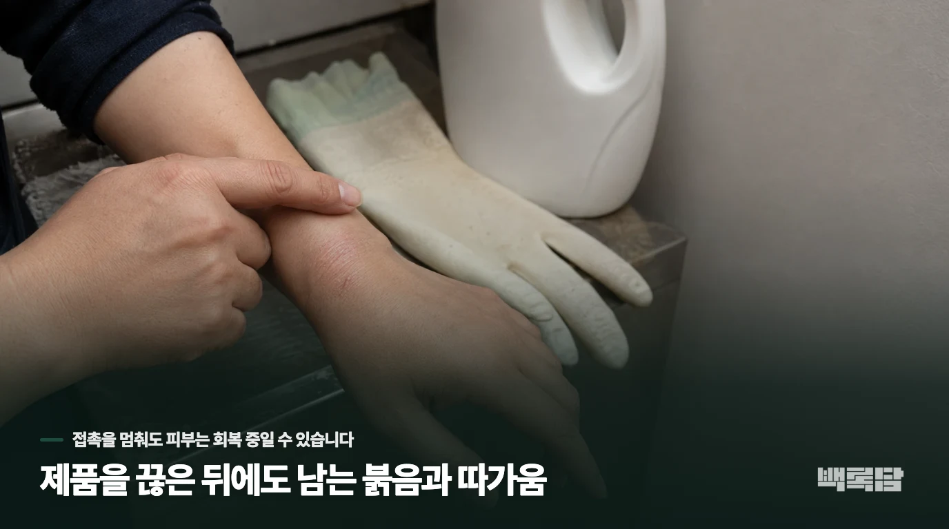 제품을 끊은 뒤에도 남는 붉음과 따가움
