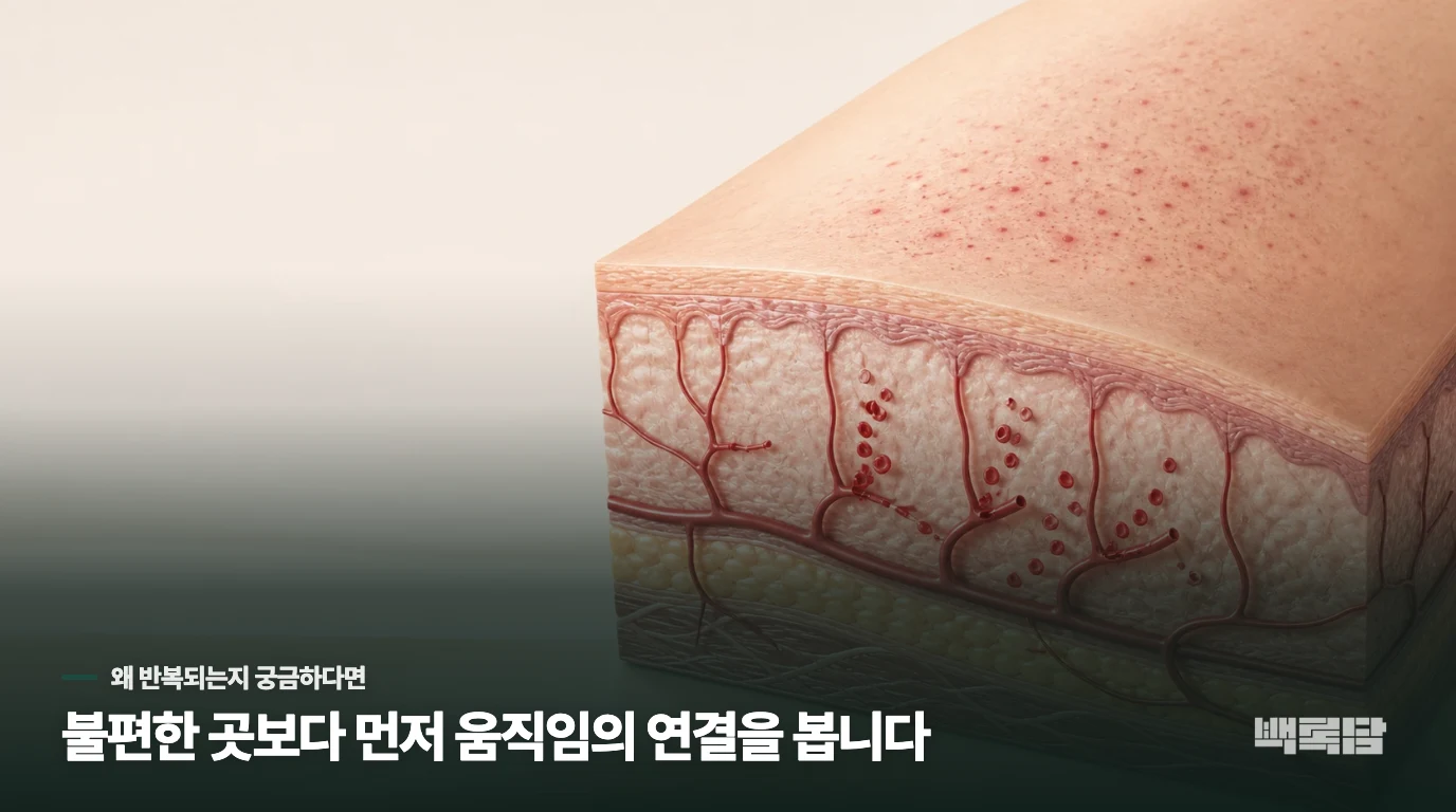 자반증의 원인, '피부'가 아니라 '혈관과 면역'의 문제입니다