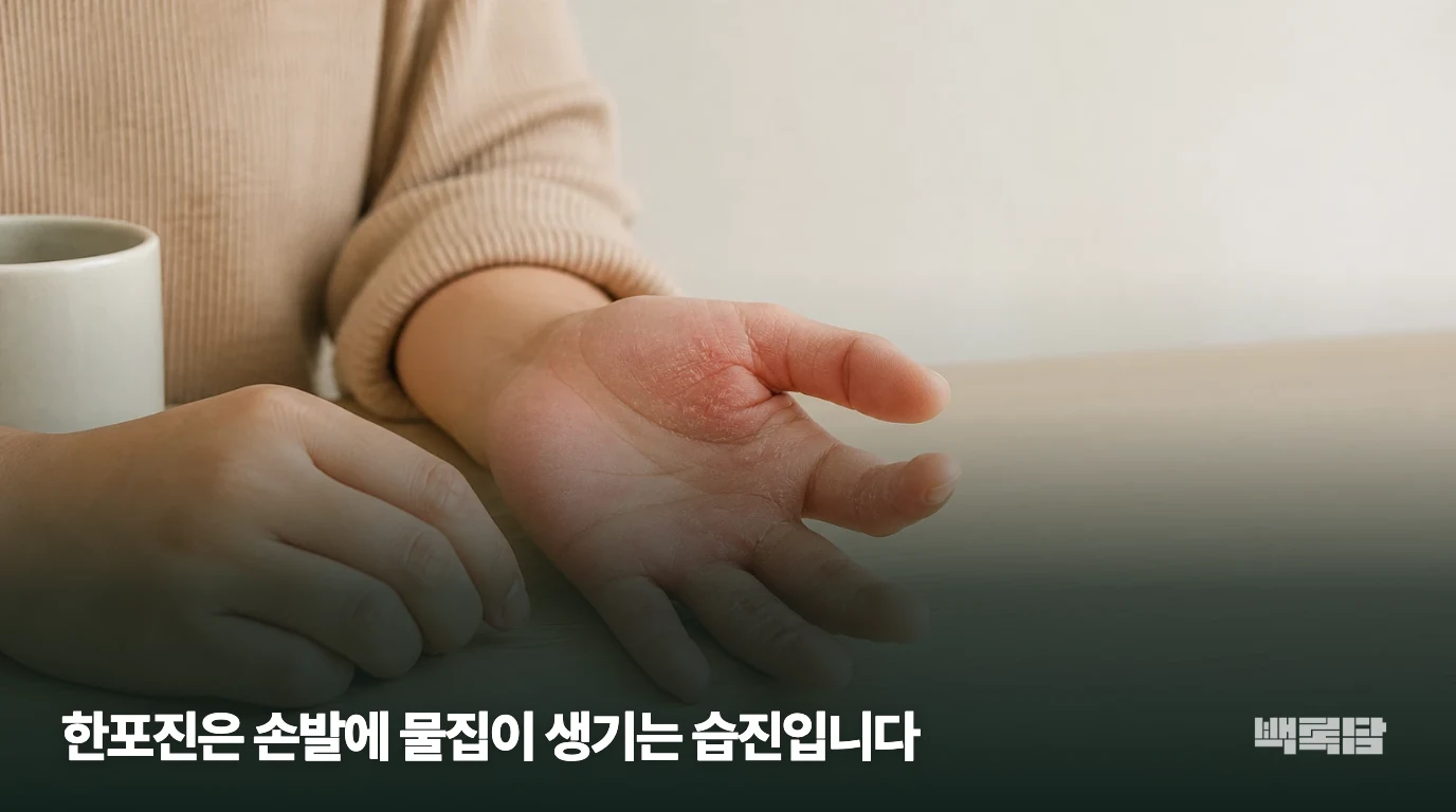한포진은 손발에 물집이 생기는 습진입니다