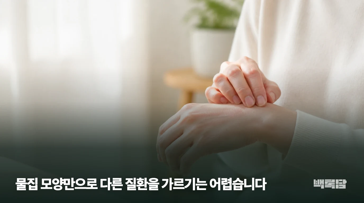 물집 모양만으로 다른 질환을 가르기는 어렵습니다