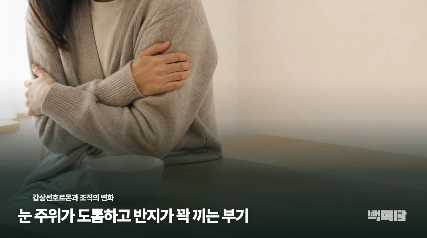 눈 주위가 도톰하고 반지가 꽉 끼는 부기
