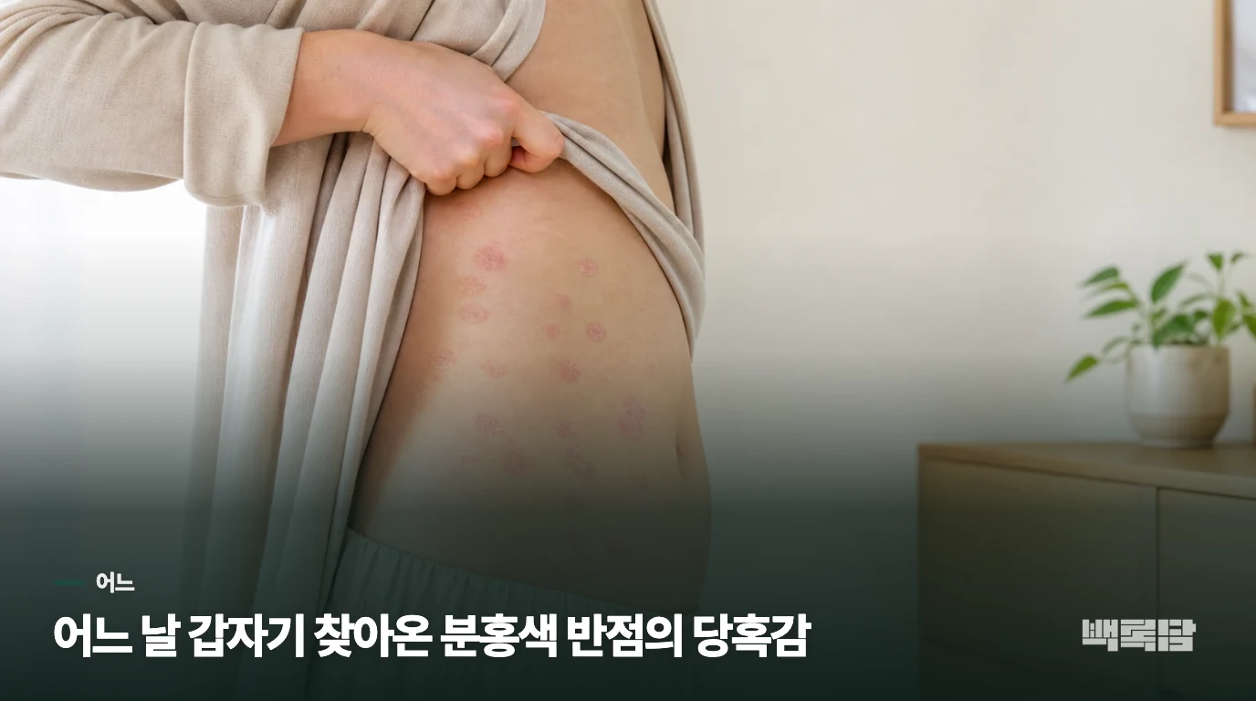 어느 날 갑자기 찾아온 분홍색 반점의 당혹감