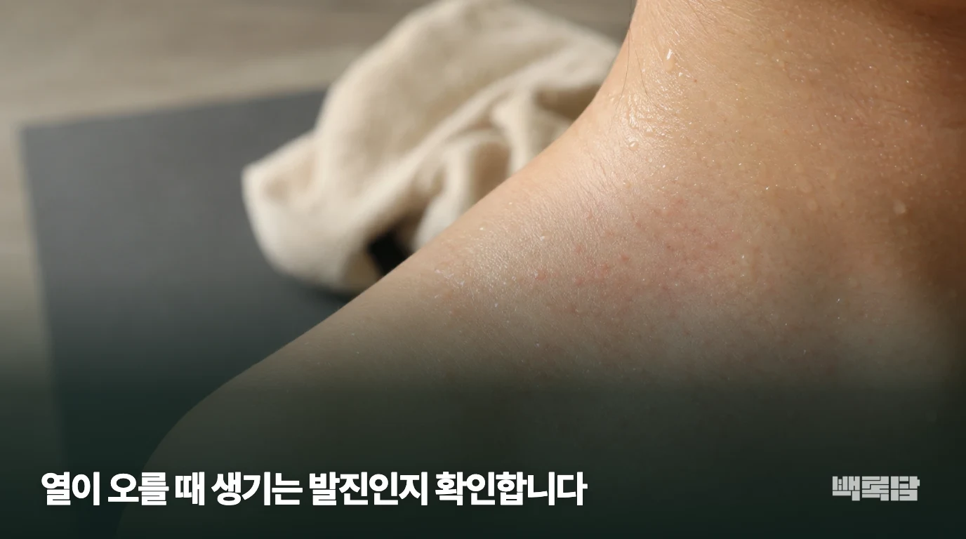 열이 오를 때 생기는 발진인지 확인합니다