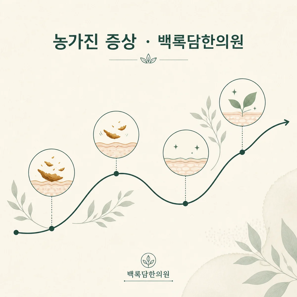 농가진의 회복은 직선이 아니라 '굴곡'이 있습니다 — 섹션 주제를 상징하는 에디토리얼 일러스트 카드