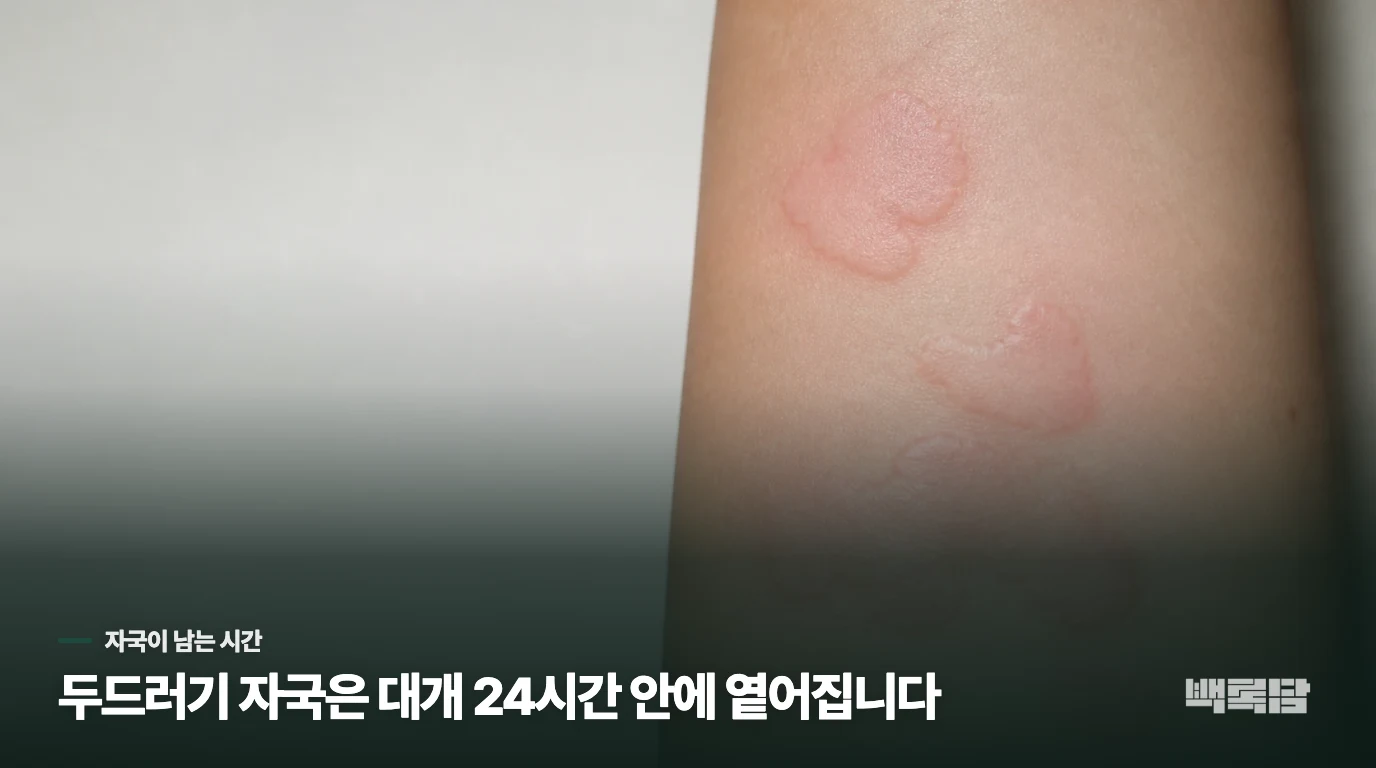 부풀고 가려운 자국이 몇 시간 만에 옮겨 다니나요?