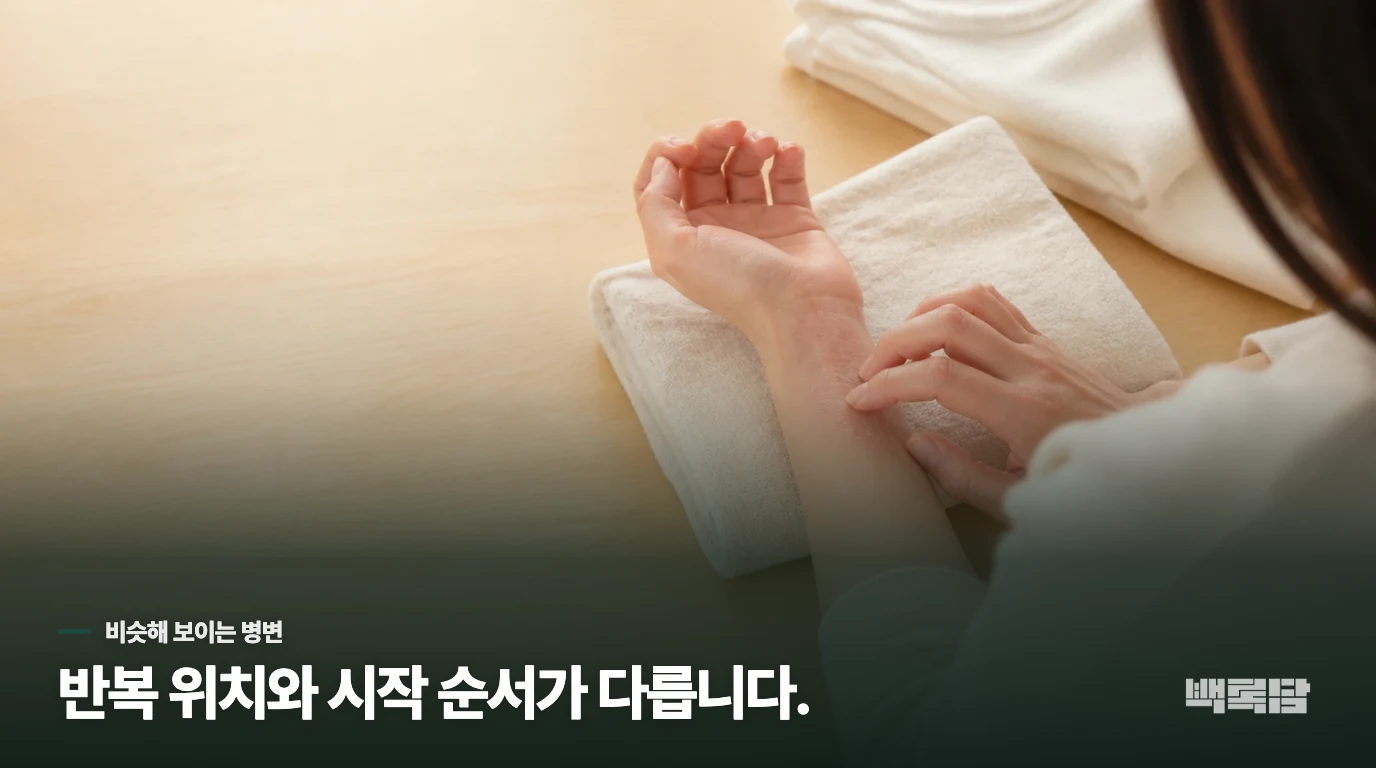 단순포진·접촉성 피부염과는 시작 장면이 다를 수 있습니다