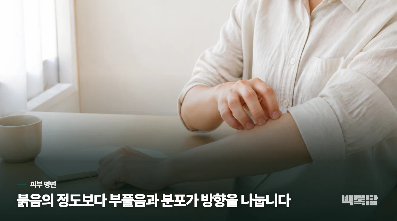 부풀거나 특정 부위에 몰리면 건조함과 다른 길입니다