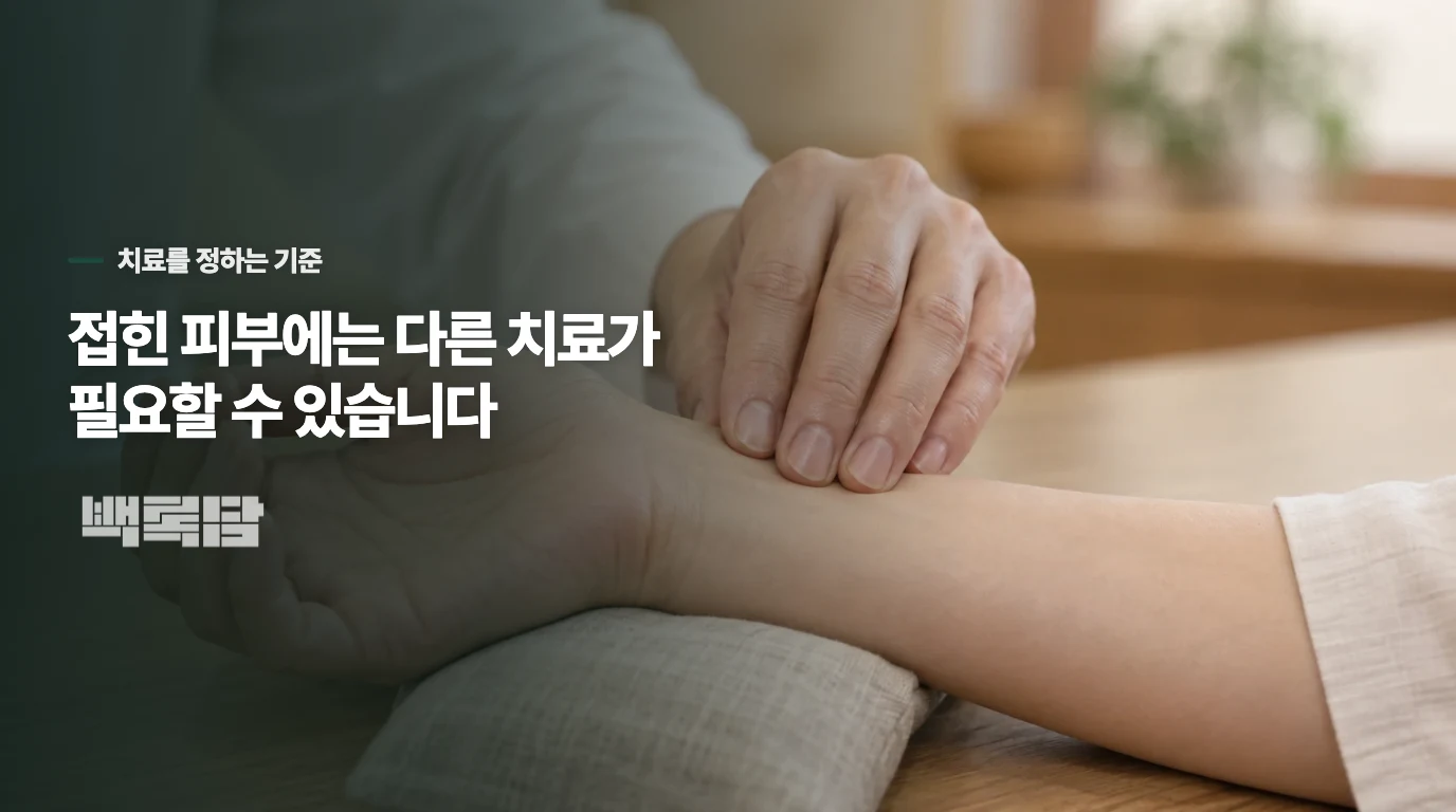 건선으로 확인되면 접힌 피부에 맞춰 치료합니다